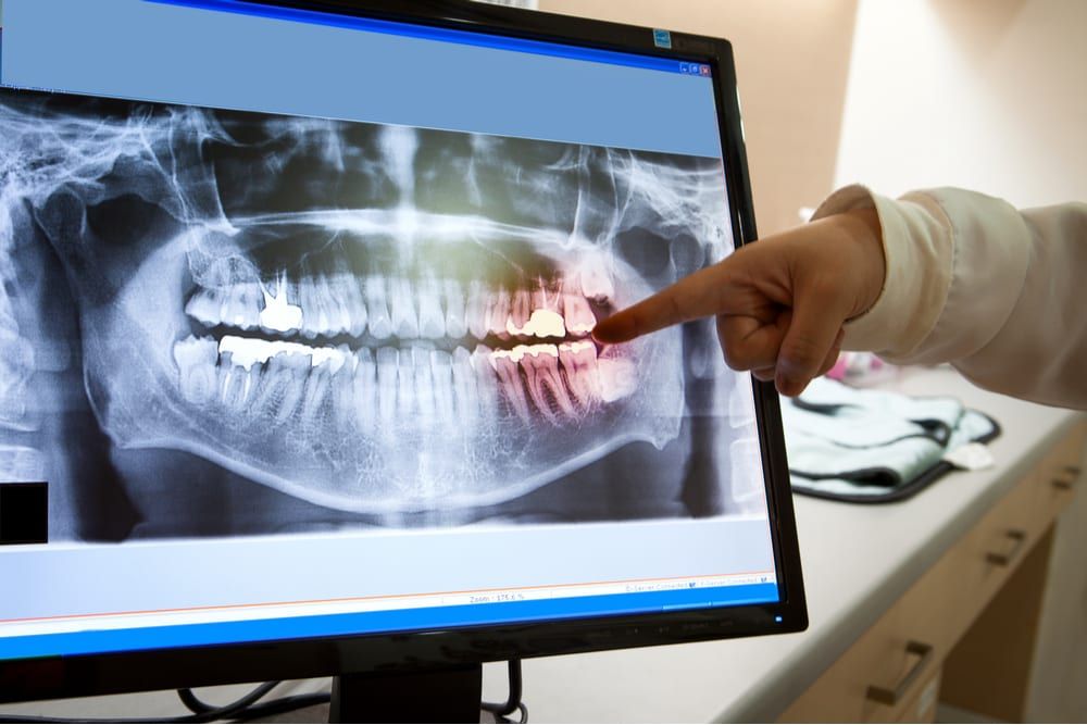 doctor examining dental x ray