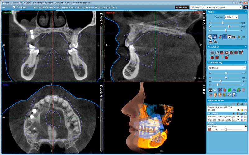dental x-rays using the ProMax 3d Mid
